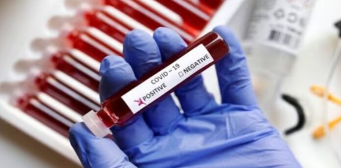 ಕೋವಿಡ್‌